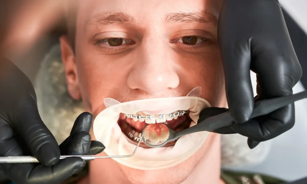 Image default